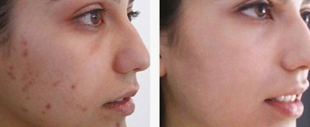 Before & After